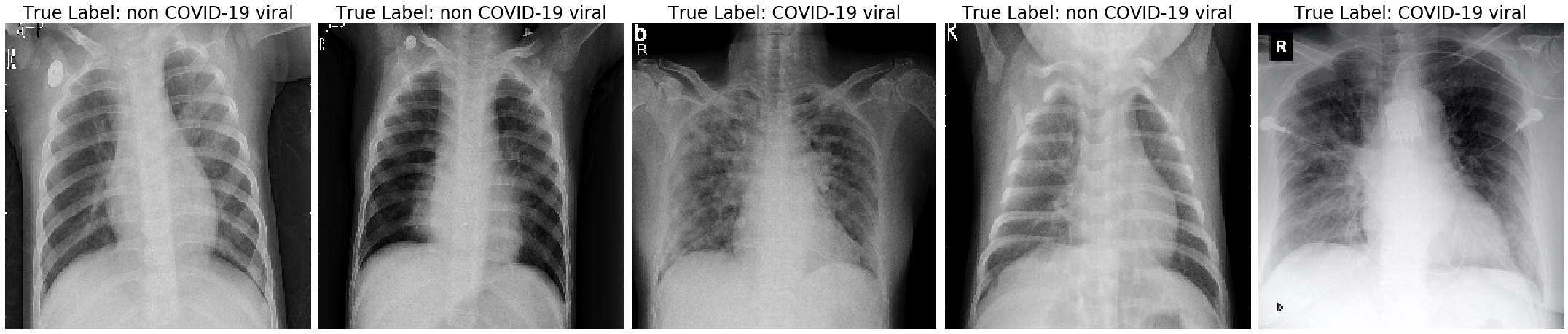 Sample Chest X-rays